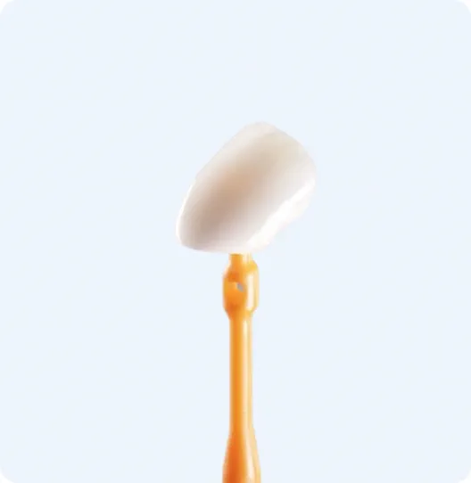 Facette dentaire tenue au bout d'un applicateur orange