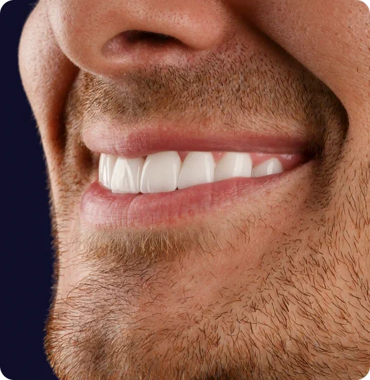 Gros plan sur un sourire aux dents blanches