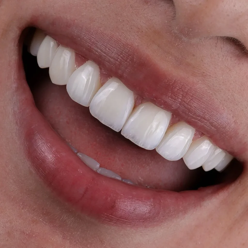 Sourire éclatant