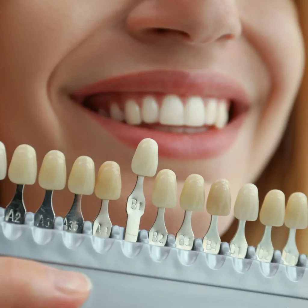Teinte des dents